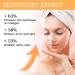 Glycolic Acid 7% Toning Resurfacing Solution - Glycolic Sour 7% Toner - Hydrating Toning Solution - Skincare Hyaluronic Acid Serum - for Blemishes and Acne Prevents Skin Aging Strengthen Your Skin - Buy Online on GoSupps.com