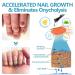 Onycholysisheal Nail Strengthening & Growth Scheme - Repair Damaged Nails Enhance Thickness & Length Nourishing Slide Care Oil (1 PC) - Shop Internationally! - Buy Online on GoSupps.com