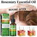 Rosemary Oil for Hair 100% Pure Rosemary Essential Oil for Eyebrow and Eyelash Nourishes The Scalp Stimulates Hair Growth for Men Women 30ml - Buy Online on GoSupps.com