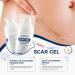 OUKEYA Gel Anti-Cicatrices au Silicone Cr me R paratrice pour Cicatrices Anciennes et R centes Acn Vergetures Chirurgie et K lo des Soin Transparent pour Tous Types de Peau 30ml - Buy Online on GoSupps.com