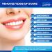 Teeth Whitening Kit + Blue Light Whitening | X8 Gels & 5 Professional Whitening Strips - 45+ Whitening Sessions - Safe for Teeth & Gums with - Buy Online on GoSupps.com