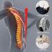 SFKLYU Adjustable Cervical Thoracic Halo Brace - E scoliosis Corrector & Posture Support for Kyphosis & Hunch Relief - Small Size - Buy Online on GoSupps.com