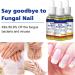 Nail Fungal Treatment Toenail Treatment Extra Strong Nail Repair Set Fingernail Toenail Care Fix Renew Damaged Broken Anti Fungus Nail Repair - Buy Online on GoSupps.com