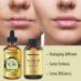 High Terpinen Australian Tea Tree Oil - Combat Acne, Toenail Problems, Dandruff - 1 fl oz - Buy Online on GoSupps.com