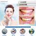Smile Sciences Teeth Whitening Gel Refill Syringe - Fast Results, Remove Stains, Peppermint Flavor - Buy Online on GoSupps.com