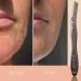 Buy Brandluxe Dermaplaning Tool | Eco-Friendly Face & Eyebrow Hair Removal | Women's Peeling Tool with Carbon Bag - Buy Online on GoSupps.com
