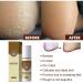 JISKG South Moon Feet Spray - Refreshing Foot Deodorizer for Hygienic & Healthy Feet - Buy Online on GoSupps.com