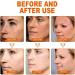 Aobenz Spot Remover For Face Aobenz Spot Remover Serum Aobenz Anti Spot Brightening And Removing Freckles Hyperpigmentation Treatment Spot Remover Serum Face Serum For All Skin Types - Buy Online on GoSupps.com