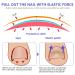Ingrown Toenail Treatment - Painless Corrector Strips & Nail Correction Patches | 100 Pcs - Buy Online on GoSupps.com