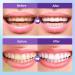 Microcrystalline Hydroxyapatite Powder Microcrystalline Hydroxyapatite 50g Hydroxyapatites Toothpaste Stain Removal Fresh Breath - Buy Online on GoSupps.com