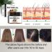 Uocasi Black Batana Oil - 100% Pure Organic Hair Growth Treatment Prevents Dry Hair & Split Ends (4.2 OZ - Buy Online on GoSupps.com