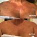 Wrinkles Schminkles Brightening Chest & D collet Sheet Mask - Vitamin C, B3, Hyaluronic Acid - Buy Online on GoSupps.com
