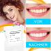 Buy Aisely Tooth Sandpaper - 2 Dental Polishing Strips 4mm Wide 6m Roll - Interdental Grinding Tools for Polishing Teeth - Blue - Buy Online on GoSupps.com