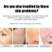 Dark Spot Remover for Face & Body Dark Spot Corrector Cream Age Spot Remover for Face Spot Cream Dark Spot Corrector Freckle Remover Cream Dark Spot Correcting Glow Serum Dark Spots Remover 20 g - Buy Online on GoSupps.com