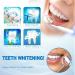 Probiotic Toothpaste Yizman | Japanese Probiotics for Whitening & Gum Health | Deep Cleaning & Fresh Breath (3PC) - Buy Online on GoSupps.com