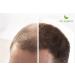 Buy My Organic Hair Defection Spout - 100% Natural & Vegan Hair Treatment - 26g for Immediate Results on Light to Dark Blonde Hair - Buy Online on GoSupps.com