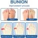 EXQST Anti Bunions Health Sock 5-Pair Set for Women - Bunion Corrector & Toe Alignment Relief Socks - Breathable One Size Fits All - Buy Online on GoSupps.com