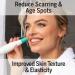 Silk N Revit Blackhead Remover Vacuum Microdermabrasion Machine for Cleansing and Exfoliating - Buy Online on GoSupps.com