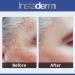 Dark Spot Corrector Cream | Fade Sun Spots, Acne Scars & Age Spots | Brighten Skin Tone with Hyaluronic Acid | Face & Body Treatment - Buy Online on GoSupps.com