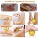 4 Skills Igelball Massage & 10 Acupressure Rings Set for Stress Relief - Metal Hedgehog Balls & Finger Rings - Gold Acupressure Solutions - Buy Online on GoSupps.com