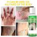 Dark Skin Exfoliating Oil Extra Strong Green for Hands Feet and Whole Body for at-home facial chemical exfoliation (220 ml/7.76 oz) - Buy Online on GoSupps.com