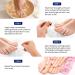 Fungal Nail Treatment Kit - Stop Fungus & Restore Healthy Toenails - Buy Online on GoSupps.com
