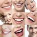 XLBHSH 5 Sets Cosmetic Veneers - Instant Perfect Smile for Dating & Work | Snap-On Teeth Braces (5 Upper & 5 Lower) with Box - Buy Online on GoSupps.com