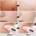 Buy Hyaluronic Acid Serum 30ml | Deeply Moisturizing & Reduces Fine Lines | Soothing Skin Essence for Sensitive Skin - Buy Online on GoSupps.com