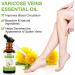 Varicose Veins & Spider Veins Essential Oil for Improved Leg Circulation - 30ML - Buy Online on GoSupps.com