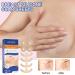 WWDZ 4 Pairs Breast Scar Sheets - Surgical Scar Removal Patches for Healthy, Flattened, and Faded Scars - Buy Online on GoSupps.com