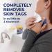 Dr. Scholl's Freeze Away Skin Tag Remover - 8 Ct | FDA-Cleared & Clinically Proven | Removes in 1 Treatment - Buy Online on GoSupps.com