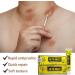 BSMAX 5PCS Natural Chinese Herbal Eczema Psoriasis Creams for Dermatitis & Pruritus - Psoriasis Ointment - Buy Online on GoSupps.com