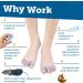 SIQWE 2pcs Toe Separators - Bunion Corrector Toe Spacers for Toe Alignment and Pain Relief - Buy Online on GoSupps.com