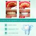 Probiotics Bright Whitening Teeth Mousse | 2024 Herbal Oral Repair Treatment | Deep Stain Removal Foam (2PCs) - Buy Online on GoSupps.com