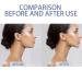 BSitsss 6-Piece Jawline Trainer Set | Kiefer Trainer & Jaw Coach for a Defined Jawline | Silicone Exerciser & Double Chin Reducer - Buy Online on GoSupps.com