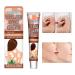 White Spot CreamWhite Spots Skin Repigmentation and Relief Cream 20g Repigmentation and Removal Cream Easy to Apply Improve Skin Pigmentation for Boiler