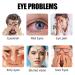 Eye Mask for Dry Eyes Dark Circles Relief - Ideal Gift for Women Men - 20 Units/Box - White - 1 Count - Buy Online on GoSupps.com