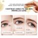 60 PCS Under Eye Patches - Brightening Collagen Eye Masks for Puffy Eyes & Dark Circles Reduces Wrinkles & Relieves Pressure - Buy Online on GoSupps.com