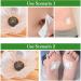 Mugwort Belly Patch Set - 90Pcs Wormwood Essence Pills and Sticker for Moxa Hot Moxibustion - Natural Navel Wormwood Sticker - Pack of 3 Boxes - Buy Online on GoSupps.com
