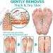 Professional Callus Remover Extra Strength Spray Foot Callus Removal Spray Foot Peeling Spray for Remove Dead Skin and Calluses on Feet (2Pcs) - Buy Online on GoSupps.com