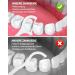 Netonda 200 PCS Gentle Dental Insult for Sensitive Gums | Fluffzen Fluff-Tahnband for Pain-Sensitive Teeth - Ideal for Dental Rooms - Buy Online on GoSupps.com