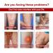 Varicose Vein Cream for Legs | Improve Blood Circulation & Strengthen Health | Effective Varicose Vein Treatment (1PC) - Buy Online on GoSupps.com