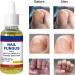 Extra Strong Nail Fungal Treatment Set for Damaged Toenails & Fingernails - Anti Fungus Nail Repair Solution - Buy Online on GoSupps.com