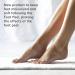 Baby Foot Moisturizing Foot Mask - 15-Minute Non-Peeling Treatment for Hydrated & Smooth Feet - Unscented, Ideal for Men & Women - Buy Online on GoSupps.com