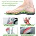Alled Orthotic Insoles with Arch Support for Women Men - High Arch Inserts for Flat Feet & Plantar Fasciitis - Orthotics for Running & Walking - Size S (Men 7-8.5/Women 8-9.5) - Buy Online on GoSupps.com