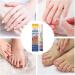 Stylo cuticules Adoucissant naturel Stylo huile pour cuticules Pour ongles la maison femmes hommes adultes manucure morsure - Buy Online on GoSupps.com