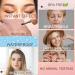 240 Pieces Invisible Eyelid Tapes L Instant Eyelid Lift Strips One-sided Sticky Eyelid Sticker with Tweezers Fork Bar Waterproof and Sweatproof for Heavy Hooded Droopy Uneven Mono-Eyelids - Buy Online on GoSupps.com