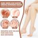 Strong whitening cream for dark knees and elbows The most popular whitening cream in 2023 Dark spot correcting cream Whitening cream for the intimate area Moisturizing the skin - Buy Online on GoSupps.com