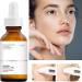 KOAHDE Amygdalin Acid Moisturizing Serum Amygdalin Acid Shrink Pores Facial Serum Amygdalin Acid Anti Wrinkle Serum Amygdalin Acid Whitening Serum Amygdalin Acid Hydrating Serum Dark Spots Reduce - Buy Online on GoSupps.com