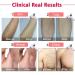IMENE IPL Permanent Hair Removal for Women & Men - 500,000 Flashes, Ice Compress, Home Use - Buy Online on GoSupps.com